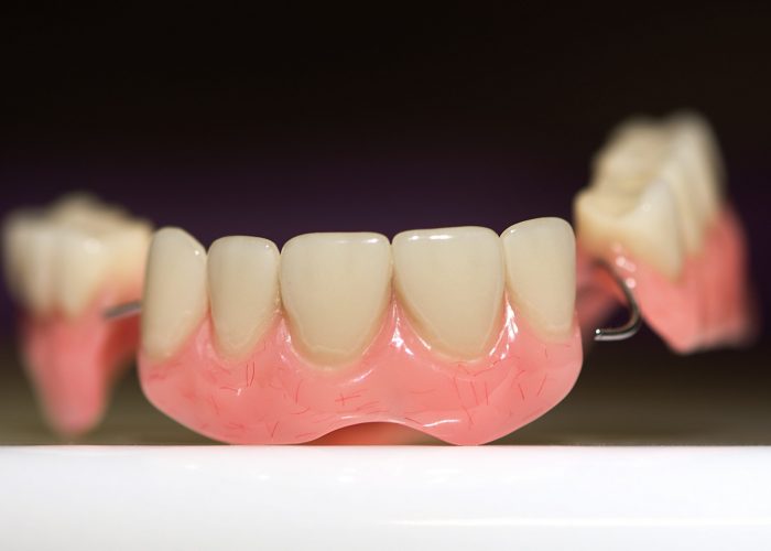 dental-prosthesis-on-dark-background-2021-08-29-01-11-15-utc